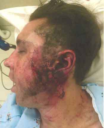 danny-califf-explossion-e-cigarette