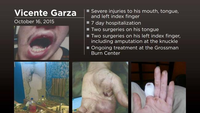 e-cigarette-explosin-vince-garza