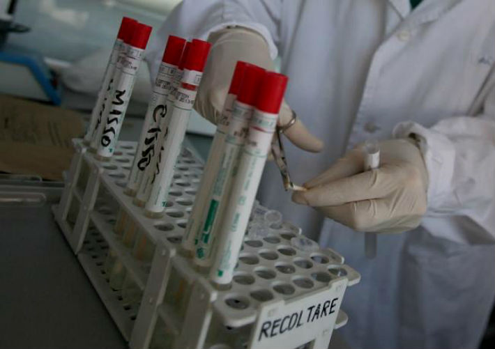 ancheta-epidemiologica-in-cazul-elevilor-suspectati-de-toxiinfectie-dupa-consumul-de-lapte-si-corn