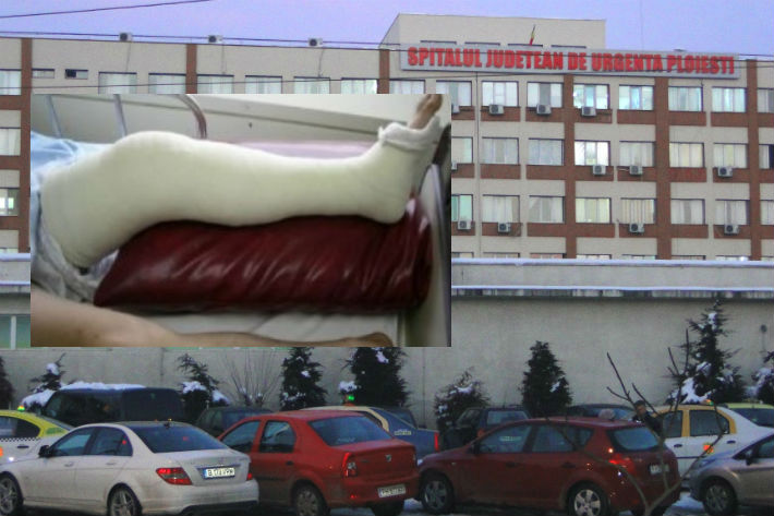 picior-rupt-pacienta-SJU-Ploiesti